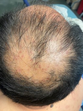 Structure of a PV Cell