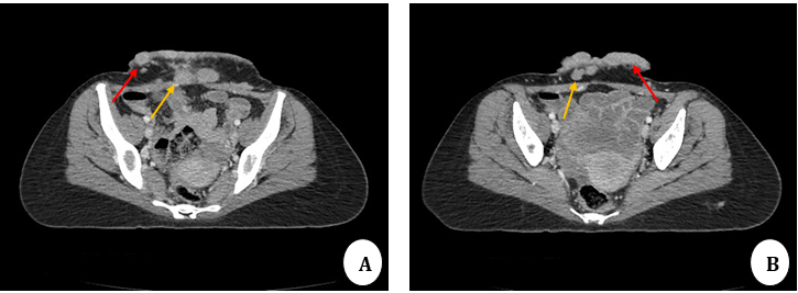 Contrast-enhanced CT scan axial images
