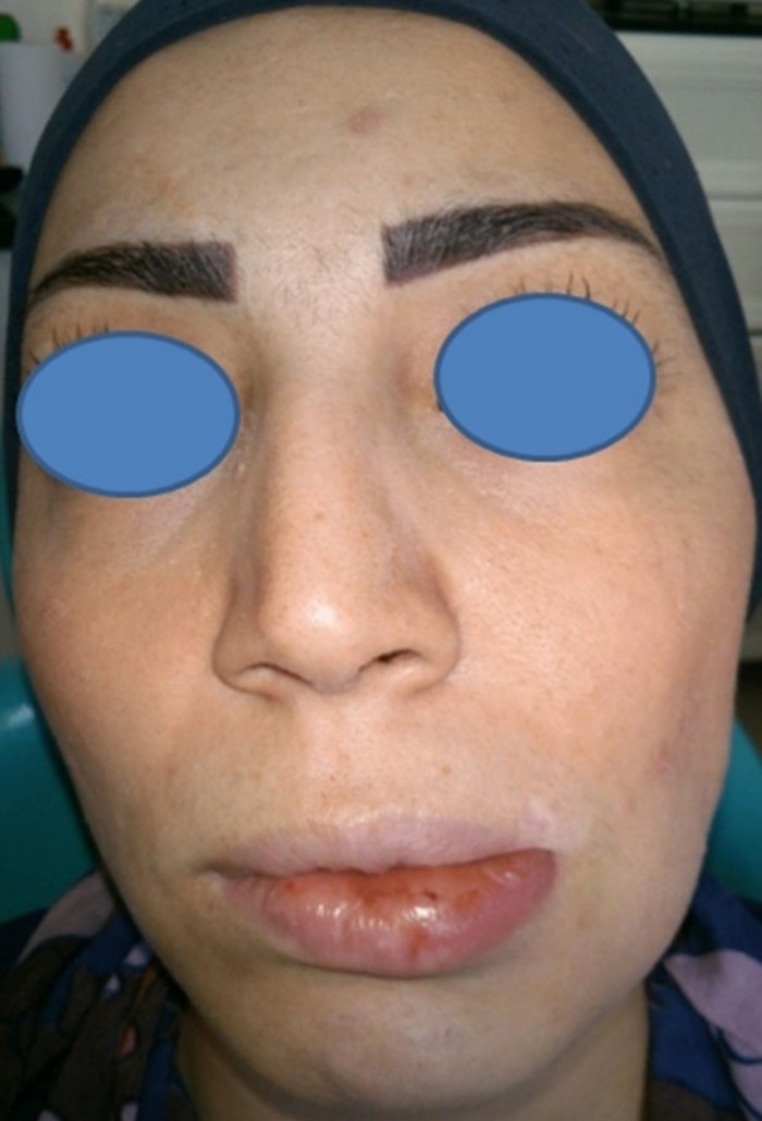 Figure 1. Photograph showing the facial swelling.5