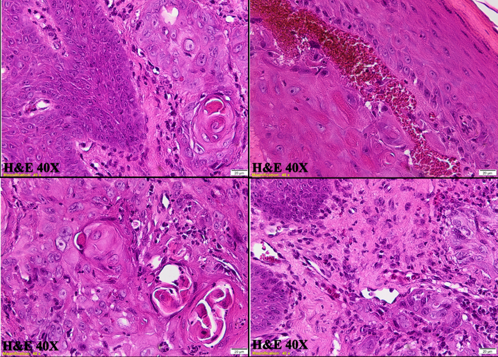 Microscopic features of the lesion